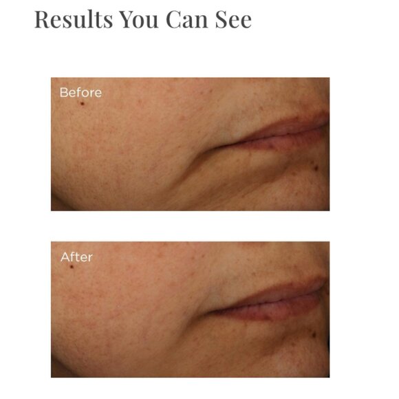 Perricone MD Multi-Action Overnight Intensive Firming Mask - Picture 7 of 15